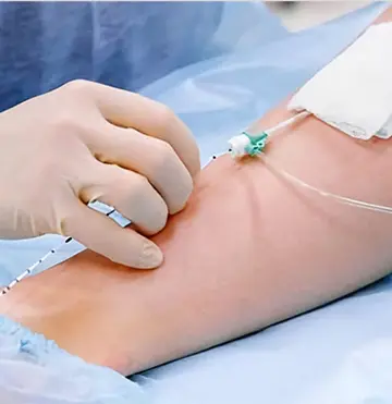 Hapros offers professional phlebology laser machines.