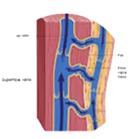 HAPROS - PERFORATOR VEIN INCOMPETENCE laser fiber